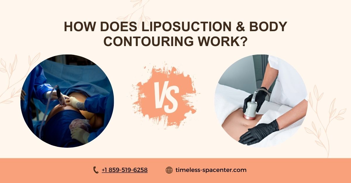 How Does Liposuction & Body Contouring Work